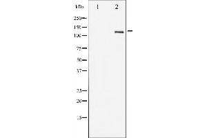 Western blot analysis of HER2 expression in 293 whole cell lysates,The lane on the left is treated with the antigen-specific peptide. (ErbB2/Her2 anticorps  (C-Term))