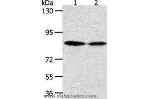 Western blot analysis of Hela and SKOV3 cell, using ADAM11 Polyclonal Antibody at dilution of 1:500 (ADAM11 anticorps)