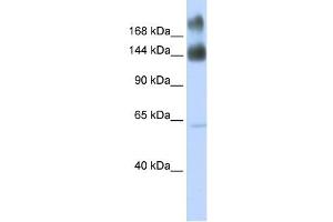Kinectin 1 antibody used at 1 ug/ml to detect target protein. (KTN1 anticorps)