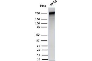 Western Blot Analysis of Human HeLa cell lysate using Spectrin alpha 1 Mouse Monoclonal Antibody (SPTA1/1832). (SPTA1 anticorps  (AA 356-475))