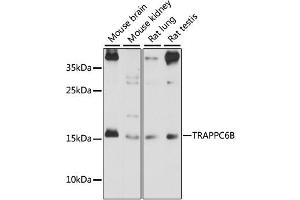 Western blot analysis of extracts of various cell lines, using TRAPPC6B antibody (ABIN6293632) at 1:1000 dilution. (TRAPPC6B anticorps)