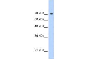 Western Blotting (WB) image for anti-Signal Transducer and Activator of Transcription 1, 91kDa (STAT1) antibody (ABIN2461817) (STAT1 anticorps)