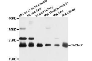 Western blot analysis of extracts of various cell lines, using CACNG1 antibody (ABIN4903103) at 1:1000 dilution. (CACNG1 anticorps)
