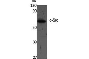 Western Blotting (WB) image for anti-Proto-oncogene tyrosine-protein kinase Src (Src) (Tyr419) antibody (ABIN5961533) (Src anticorps  (Tyr419))