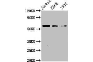 Western Blot Positive WB detected in: Jurkat whole cell lysate, K562 whole cell lysate, 293T whole cell lysate All lanes: CFLAR antibody at 4 μg/mL Secondary Goat polyclonal to rabbit IgG at 1/50000 dilution Predicted band size: 56, 26, 42, 28, 52, 51, 40, 31, 35, 53, 34, 24, 50, 45 kDa Observed band size: 56 kDa (FLIP anticorps  (AA 1-250))