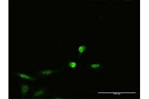 Immunofluorescence of monoclonal antibody to PNMA2 on HeLa cell.