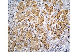IHC analysis of PPA1 using anti-PPA1 antibody (ABIN6719527). (Pyrophosphatase (Inorganic) 1 (PPA1) (AA 7-236) anticorps)