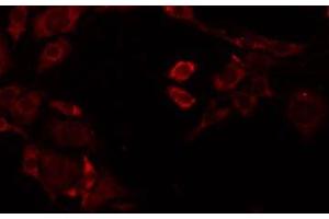 ABIN6277898 staining Hela by IF/ICC. (Renin anticorps  (Internal Region))