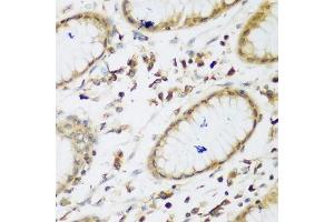 Immunohistochemistry of paraffin-embedded human gastric using UBE3A antibody. (ube3a anticorps  (AA 300-590))