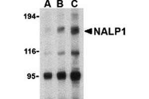 Western Blotting (WB) image for anti-NLR Family, Pyrin Domain Containing 1 (NLRP1) (C-Term) antibody (ABIN1030530) (NLRP1 anticorps  (C-Term))