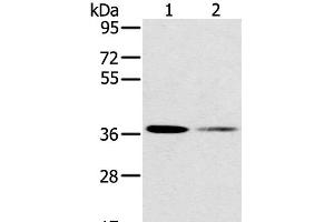 Western Blot analysis of 293T and Raji cell using SMN1 Polyclonal Antibody at dilution of 1:200 (SMN1 anticorps)