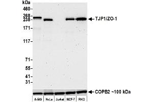 Western Blotting (WB) image for anti-Tight Junction Protein 1 (TJP1) (AA 650-700) antibody (ABIN7455191) (Recombinant TJP1 anticorps  (AA 650-700))