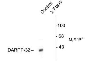 Western blots of rat caudate lysate showing specific immunolabeling of the ~32k DARPP-32 phosphorylated at Thr34 (Control). (DARPP32 anticorps  (pThr34))