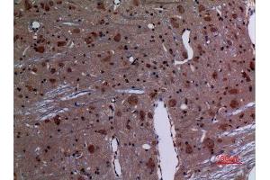 Immunohistochemistry (IHC) analysis of paraffin-embedded Rat Brain, antibody was diluted at 1:100.