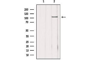 Western blot analysis of extracts from mouse brain, using USP11 Antibody. (USP11 anticorps  (Internal Region))