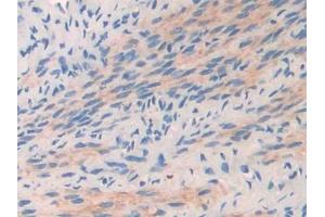 DAB staining on IHC-P; Samples: Mouse Oviduct Tissue (COL2A1 anticorps  (AA 1307-1383))