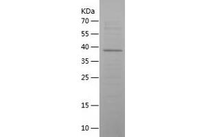 Western Blotting (WB) image for Vasoactive Intestinal Peptide (Vip) (AA 26-170) protein (His-IF2DI Tag) (ABIN7125704)