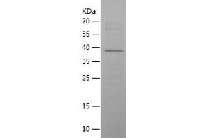 Western Blotting (WB) image for Vasoactive Intestinal Peptide (Vip) (AA 26-170) protein (His-IF2DI Tag) (ABIN7125704) (Vip Protein (AA 26-170) (His-IF2DI Tag))