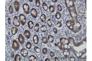 Image no. 1 for anti-Zinc Finger Protein 259 (znf259) (AA 361-460) antibody (ABIN598588) (ZNF259 anticorps  (AA 361-460))