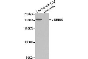 Western blot analysis of extracts from A431 cells using Phospho-ERBB3-Y1328 Antibody (ERBB3 anticorps  (pTyr1328))
