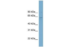 WB Suggested Anti-FAM188B2 Antibody Titration: 0.