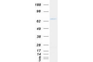 Validation with Western Blot