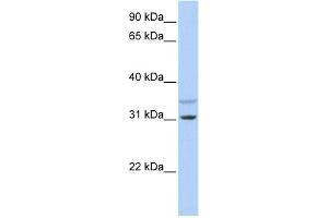WB Suggested Anti-KCNRG Antibody Titration:  0. (KCNRG anticorps  (N-Term))