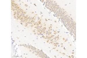 Immunohistochemistry analysis of paraffin-embedded mouse hippocampus using VAMP4 (ABIN7076198) at dilution of 1: 3000 (VAMP4 anticorps)
