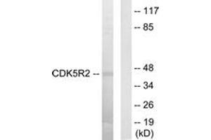 Western Blotting (WB) image for anti-Cyclin-Dependent Kinase 5, Regulatory Subunit 2 (p39) (CDK5R2) (AA 81-130) antibody (ABIN2889572)