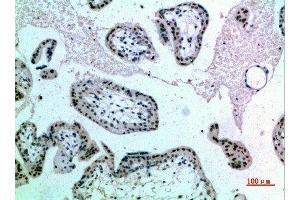 Immunohistochemical analysis of paraffin-embedded human-placenta, antibody was diluted at 1:200 (NOP56 anticorps  (AA 191-240))