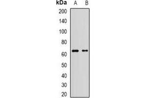 Western blot analysis of AF9 expression in Jurkat (A), A549 (B) whole cell lysates.