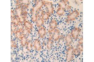 Used in DAB staining on fromalin fixed paraffin- embedded Kidney tissue (PLXNB1 anticorps  (AA 1598-1849))