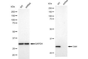 Western blotting analysis using Cdk4 antibody (ABIN7798214). (Recombinant CDK4 anticorps)