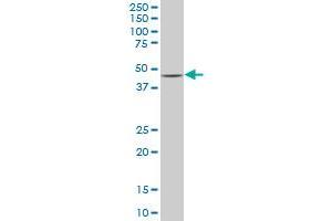 SMAD7 monoclonal antibody (M07), clone 4G11. (SMAD7 anticorps  (AA 160-260))