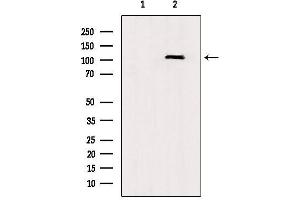 Western blot analysis of extracts from rat brain, using TLR8  Antibody. (TLR8 anticorps  (C-Term))