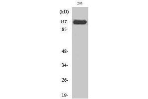 Western Blotting (WB) image for anti-Janus Kinase 2 (JAK2) (Ser642) antibody (ABIN6284346)