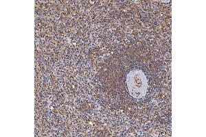 IHC analysis of Sm-D3/SNRPD3 using anti-Sm-D3/SNRPD3 antibody (ABIN7598952).