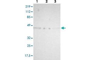 Western blot analysis of lane 1: RT-4, lane 2: U-251 MG and lane 3: A-431 cell lysates using TXNDC4 polyclonal antibody .