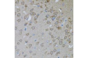Immunohistochemistry of paraffin-embedded mouse brain using ARF1 antibody. (ARF1 anticorps)
