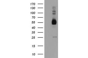 Western Blotting (WB) image for anti-Tubby Like Protein 3 (TULP3) antibody (ABIN1501583) (TULP3 anticorps)