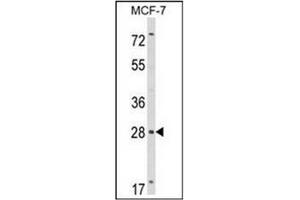 Western blot analysis of RASL11B Antibody (N-term) Cat.