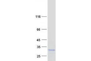 Validation with Western Blot