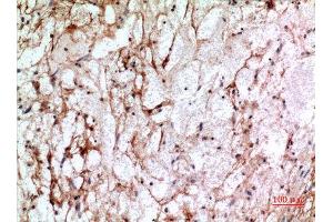 Immunohistochemistry (IHC) analysis of paraffin-embedded Human Brain, antibody was diluted at 1:100. (IFITM1 anticorps  (N-Term))