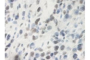 Image no. 2 for anti-Oncostatin M (OSM) antibody (ABIN465830) (Oncostatin M anticorps)