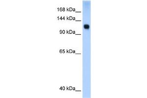 WB Suggested Anti-SMARCA5 Antibody Titration:  0. (SMARCA5 anticorps  (N-Term))