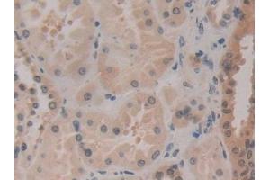 Detection of HSPA1A in Human Kidney Tissue using Polyclonal Antibody to Heat Shock 70 kDa Protein 1A (HSPA1A)