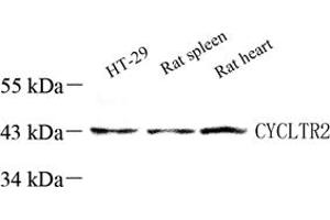 Western blot analysis of CysLT2 (ABIN7073655),at dilution of 1: 60 (CasLTR2 anticorps)