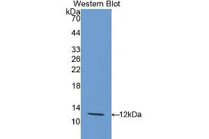 Western Blotting (WB) image for anti-Interleukin 12 Receptor, beta 2 (IL12RB2) (AA 559-647) antibody (ABIN1174180) (IL12RB2 anticorps  (AA 559-647))