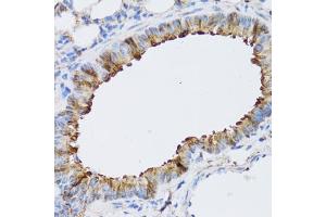 Immunohistochemistry of paraffin-embedded mouse lung using N antibody (ABIN6129932, ABIN6144318, ABIN6144319 and ABIN6222781) at dilution of 1:100 (40x lens).