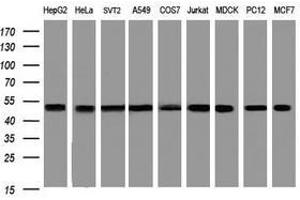 Image no. 5 for anti-SERPINE1 mRNA Binding Protein 1 (SERBP1) (AA 1-262) antibody (ABIN1490676) (SERBP1 anticorps  (AA 1-262))